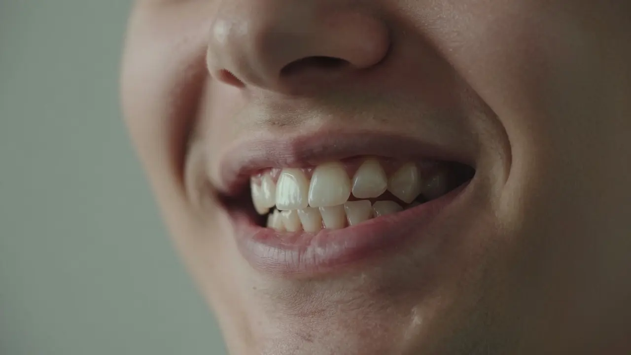 Jak poznam, že mám mít rovnátka? 7 známek, že potřebuješ ortodontické léčení