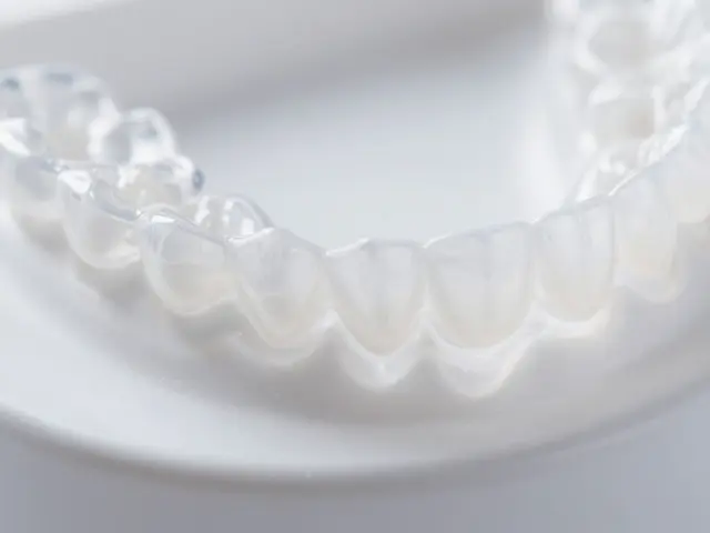 Co jsou snímací rovnátka? Typy, výhody a cena v roce 2026