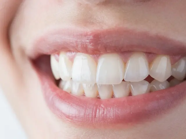 Jak dlouho vydrží keramické zuby a fazety? Pravda o životnosti