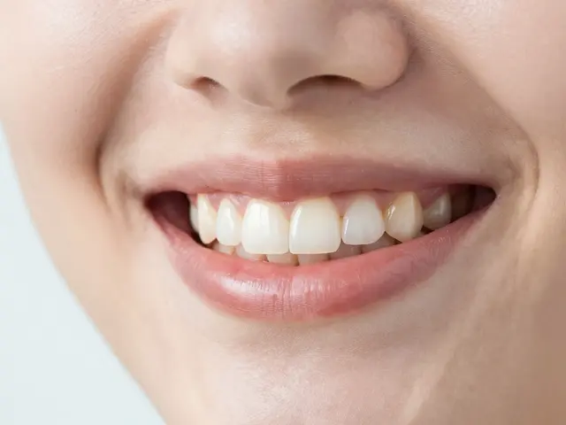 Veneers zuby: Cesta k perfektnímu úsměvu a vše, co potřebujete vědět
