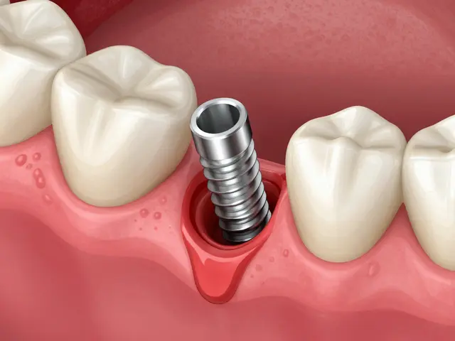 Jak dlouho se hojí zubní implantáty: Kompletní průvodce fázemi a časem
